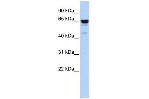 Western Blot showing ZNF587 antibody used at a concentration of 1-2 ug/ml to detect its target protein. (ZNF587 anticorps  (Middle Region))