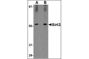 Western blot analysis of SIRT2 in Mouse brain lysate with AP30785PU-N SIRT2 antibody at (A) 1 and (B) 2 μg/ml. (SIRT2 anticorps  (C-Term))