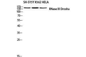 Western Blot (WB) analysis of SH-SY5Y K562 HeLa using RNase III Drosha antibody. (DROSHA anticorps)