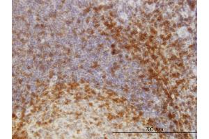 Immunoperoxidase of monoclonal antibody to SCAP1 on formalin-fixed paraffin-embedded human tonsil.