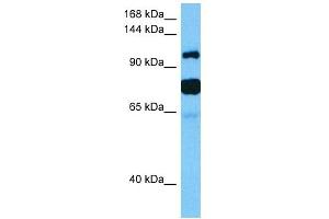 Host:  Mouse  Target Name:  HDAC4  Sample Tissue:  Mouse Testis  Antibody Dilution:  1ug/ml (HDAC4 anticorps  (Middle Region))