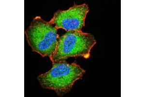 Immunofluorescence analysis of A549 cells using EZR mouse mAb (green).