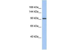 Human Muscle; WB Suggested Anti-ZNF295 Antibody Titration: 0. (ZNF295 anticorps  (N-Term))