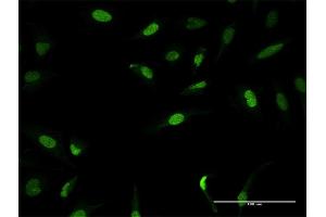 Immunofluorescence of purified MaxPab antibody to ZNF582 on HeLa cell. (ZNF582 anticorps  (AA 1-517))