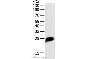 Western blot analysis of Human liver cancer tissue, using CRP Polyclonal Antibody at dilution of 1:1400 (CRP anticorps)