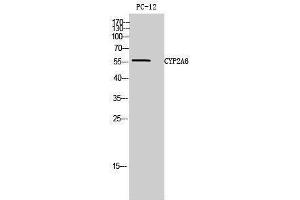 Western Blotting (WB) image for anti-Cytochrome P450, Family 2, Subfamily A, Polypeptide 6 (CYP2A6) (N-Term) antibody (ABIN3174643)