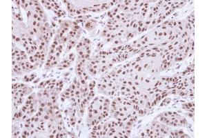 IHC-P Image Immunohistochemical analysis of paraffin-embedded Cal27 xenograft, using MST1, antibody at 1:500 dilution.
