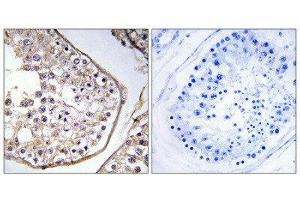Immunohistochemistry (IHC) image for anti-B Melanoma Antigen Family, Member 3 (BAGE3) (Internal Region) antibody (ABIN1850876) (BAGE3 anticorps  (Internal Region))