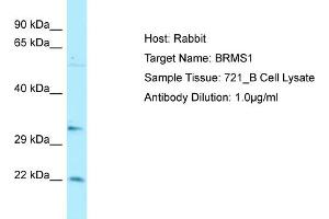 Host: RabbitTarget Name: BRMS1Antibody Dilution: 1.