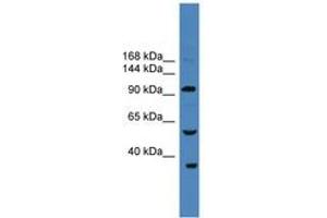 Image no. 1 for anti-Ubiquitin Specific Peptidase 29 (USP29) (AA 181-230) antibody (ABIN6745286) (USP29 anticorps  (AA 181-230))