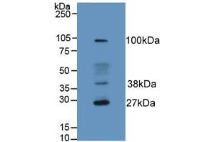 Figure. (HFE2 anticorps  (AA 234-416))