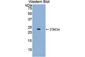 Western blot analysis of the recombinant protein. (NCF2 anticorps  (AA 354-525))