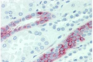 Anti-SLC4A2 antibody  ABIN1049341 IHC staining of human kidney. (SLC4A2 anticorps  (Internal Region))