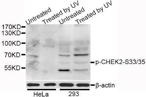 Western blot analysis of extracts of HeLa and 293 cells, using Phospho-CHEK2-S33/35 antibody (ABIN5995607) at 1/1000 dilution. (CHEK2 anticorps  (pSer33, pSer35))