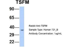 Host: Rabbit Target Name: TSFM Sample Type: Human 721_B Antibody Dilution: 1. (TSFM anticorps  (Middle Region))