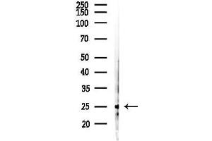 anti-Zinc Finger, DHHC-Type Containing 3 (ZDHHC3) (C-Term) antibody