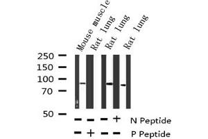 Western blot analysis of Phospho-CD44 (Ser706) expression in various lysates