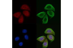 ABIN6256539 and ABIN6274072 staining Hela cells(45 min of heat-shock) by IF/ICC. (CDKN1C anticorps  (pThr310))