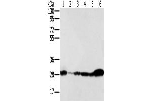 Western Blotting (WB) image for anti-NADH Dehydrogenase (Ubiquinone) Fe-S Protein 3, 30kDa (NADH-Coenzyme Q Reductase) (NDUFS3) antibody (ABIN2430525) (NDUFS3 anticorps)