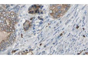 ABIN6276960 at 1/100 staining Human prostate tissue by IHC-P. (TNNC1 anticorps  (Internal Region))