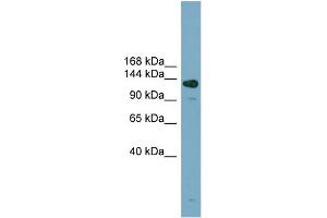 WB Suggested Anti-ASXL2  Antibody Titration: 0.