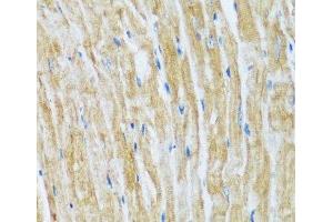 Immunohistochemistry of paraffin-embedded Mouse heart using BAG3 Polyclonal Antibody at dilution of 1:100 (40x lens). (BAG3 anticorps)