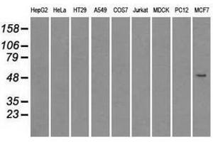 Image no. 1 for anti-Solute Carrier Family 2 (Facilitated Glucose/fructose Transporter), Member 5 (SLC2A5) antibody (ABIN1498478) (SLC2A5 anticorps)