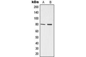 Western blot analysis of p73 expression in Jurkat (A), HeLa (B) whole cell lysates. (Tumor Protein p73 anticorps  (N-Term))