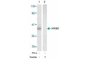 Western blot analysis of extracts from 293 cells untreated or treated with TNF-alpha (20 ng/mL, 15 min) using NFKBIE polyclonal antibody . (NFKBIE anticorps)