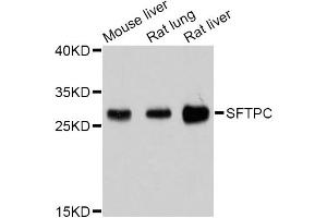 Western blot analysis of extracts of various cell lines, using SFTPC Antibody (ABIN4905145) at 1:1000 dilution. (Surfactant Protein C anticorps)