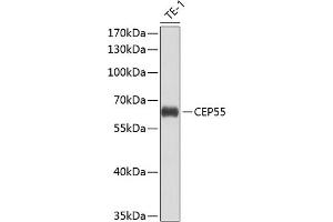 Western blot analysis of extracts of THP-1 cells, using CEP55 antibody (ABIN6127692, ABIN6138423, ABIN6138424 and ABIN6224249) at 1:1000 dilution. (CEP55 anticorps  (AA 1-260))