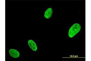 Immunofluorescence of monoclonal antibody to RUNX2 on U-2 OS cell. (RUNX2 anticorps  (AA 251-350))