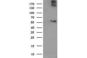 Western Blotting (WB) image for anti-Acyl-CoA Thioesterase 12 (ACOT12) antibody (ABIN1496414)