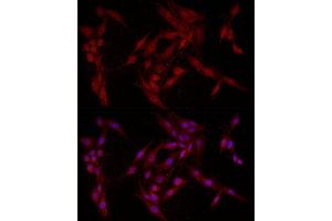 Immunofluorescence analysis of PC-12 cells using F Rabbit pAb (ABIN6127814, ABIN6140422, ABIN6140423 and ABIN6221993) at dilution of 1:200 (40x lens).