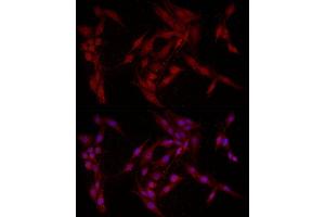 Immunofluorescence analysis of PC-12 cells using F Rabbit pAb (ABIN6127814, ABIN6140422, ABIN6140423 and ABIN6221993) at dilution of 1:200 (40x lens).