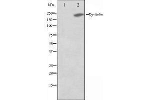 Western blot analysis on K562 cell lysate using Dysferlin Antibody,The lane on the left is treated with the antigen-specific peptide. (Dysferlin anticorps  (C-Term))