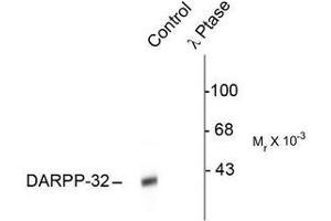 Image no. 1 for anti-Protein Phosphatase 1, Regulatory (Inhibitor) Subunit 1B (PPP1R1B) (pThr34) antibody (ABIN372606) (DARPP32 anticorps  (pThr34))