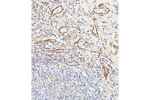 Immunohistochemical analysis of paraffin-embedded human appendix tissue using (ABIN658983 and ABIN2838032) performed on the Leica® BOND RXm. (CD34 anticorps  (AA 185-214))