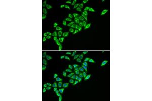 Immunofluorescence analysis of HeLa cells using DLAT antibody (ABIN6129524, ABIN6139639, ABIN6139640 and ABIN6221886).