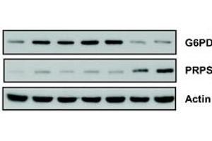 anti-PRPS1,PRPS2,PRPS3 (AA 79-109), (N-Term) antibody