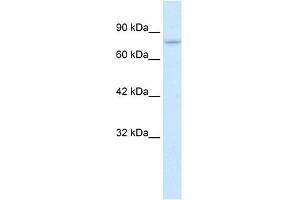 WB Suggested Anti-PIAS2 Antibody Titration:  0.