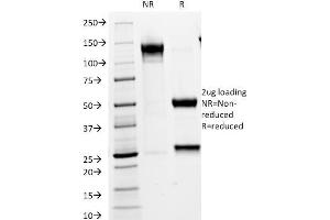 SDS-PAGE Analysis Purified VLDL-Receptor Mouse Monoclonal Antibody (VLDLR/1337). (VLDLR anticorps  (C-Term))