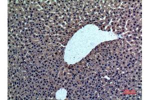 Immunohistochemistry (IHC) analysis of paraffin-embedded Rat liver, antibody was diluted at 1:100. (Prothrombin anticorps  (Internal Region))