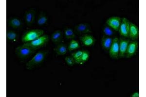 Immunofluorescent analysis of A549 cells using ABIN7171382 at dilution of 1:100 and Alexa Fluor 488-congugated AffiniPure Goat Anti-Rabbit IgG(H+L)