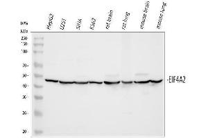 Western blot analysis of eIF4A2 using anti-eIF4A2 antibody (ABIN3043426). (EIF4A2 anticorps  (N-Term))