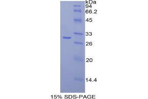 SDS-PAGE analysis of Chicken Fatty Acid Synthase Protein.