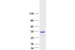 Validation with Western Blot