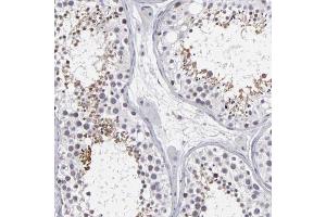 Immunohistochemical staining (Formalin-fixed paraffin-embedded sections) of human testis shows moderate cytoplasmic and nuclear positivity in seminiferous ducts with ODF2 polyclonal antibody . (ODF2 anticorps  (AA 44-205))