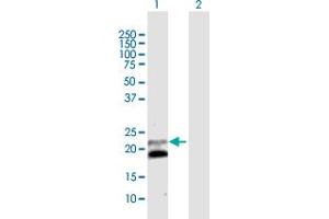 Western Blot analysis of IFNB1 expression in transfected 293T cell line by IFNB1 MaxPab polyclonal antibody. (IFNB1 anticorps  (AA 1-187))
