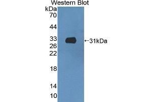 Detection of Recombinant CCDC60, Mouse using Polyclonal Antibody to Coiled Coil Domain Containing Protein 60 (CCDC60)